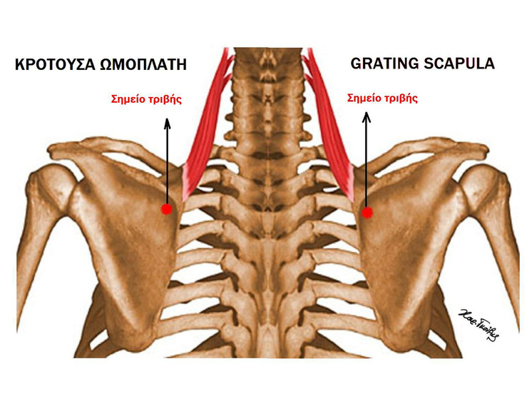Московские травматологи избавили девушку от хруста в спине
