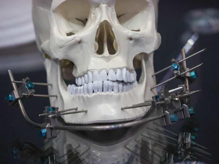 Стоматолог-ортопед Проскокова рассказала об опасностях использования брекетов